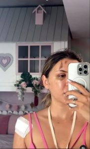 Emily Burghelea și Panglica de la Gât: Povestea Emoționantă a Supraviețuirii după Accidentul din Mauritius