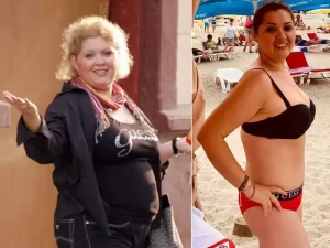 Minodora, intervenție estetică după ce a pierdut 40 de kilograme: „O să fiu frumoasă”